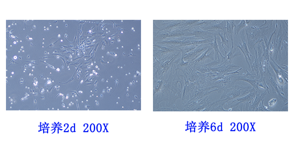 人脂肪来源的干细胞原代分离培养操作方案.png